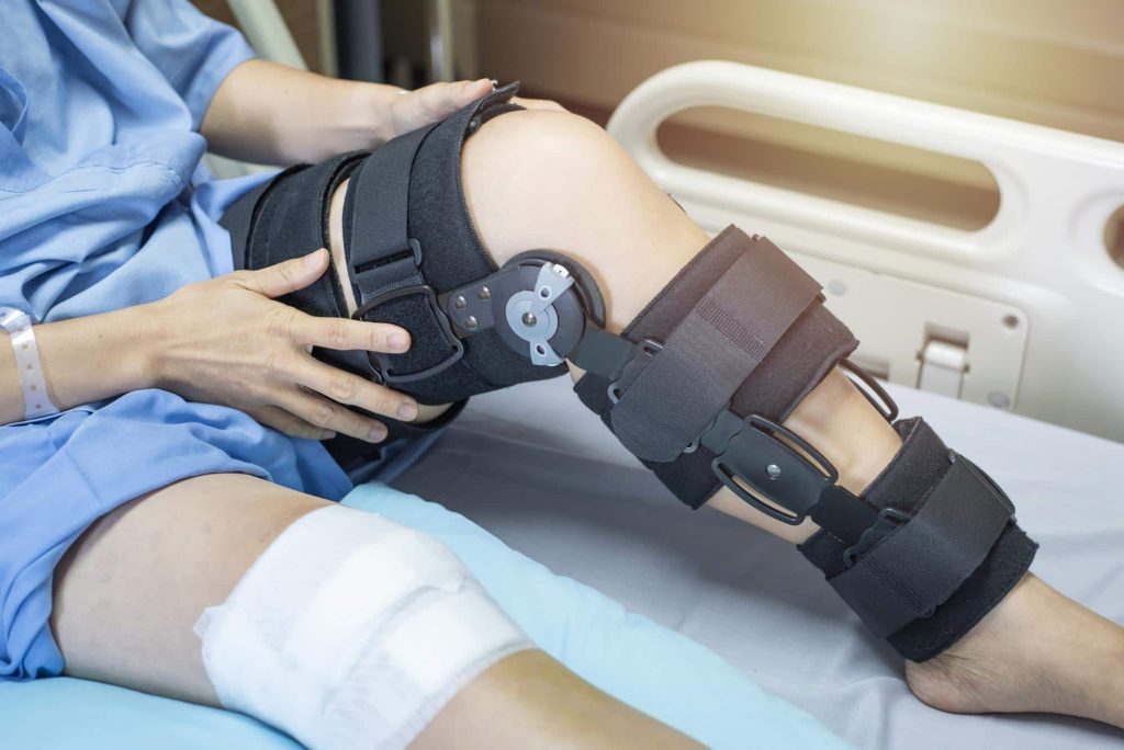 A person laying on hospital bed wearing gown, with bandage on right knee, and brace on bent left leg.