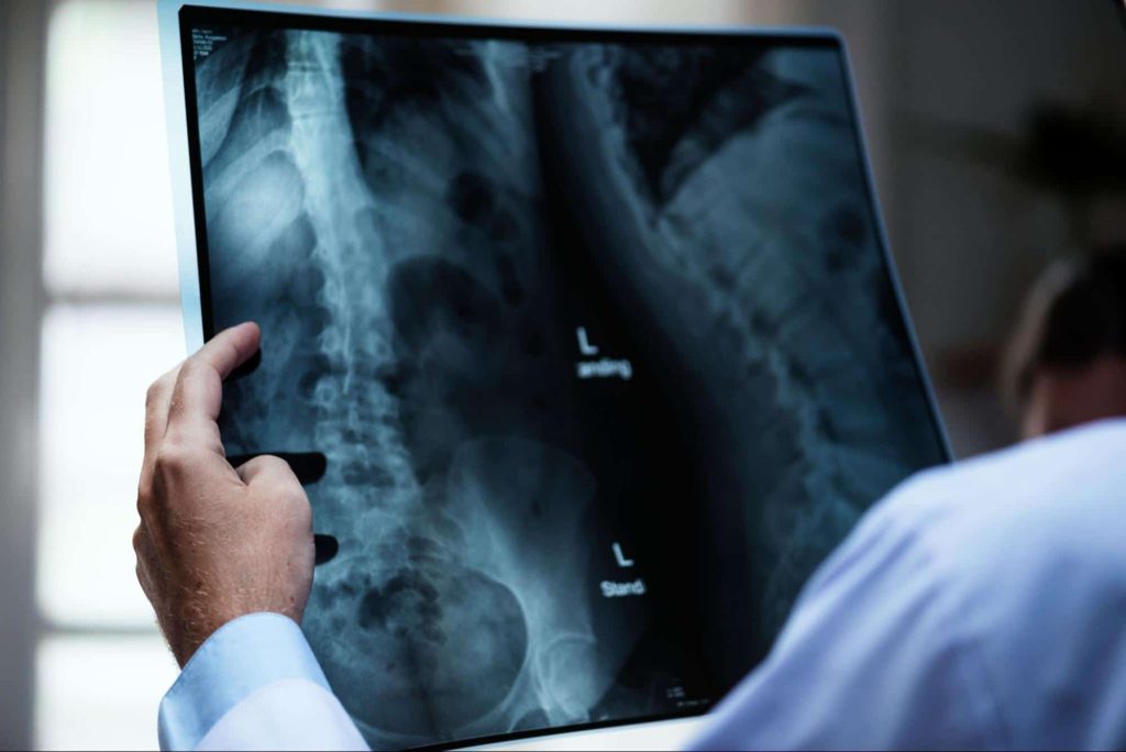 Doctor reads x-ray of injured patients spine.